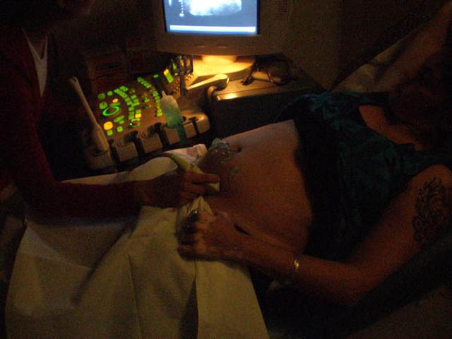 61_Ruth's_belly_with_ultrasound_goo